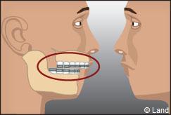 Orthodontie